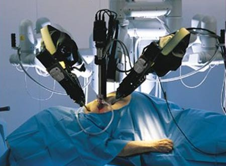 Cuộc phẫu thuật hoàn toàn bằng robot đầu tiên trên thế giới tại Canada.  Ảnh: Topnews.in